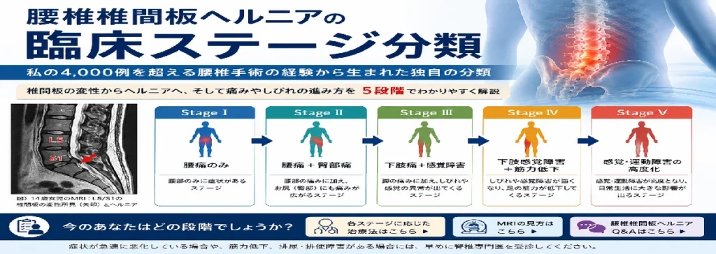 腰椎椎間板ヘルニアのステージ分類